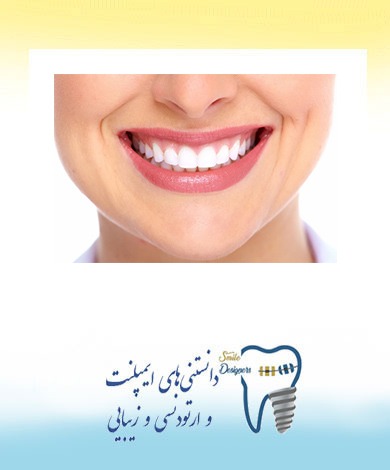 درمانهای زیبایی لبخند توسط دندانپزشک متخصص زیبایی در تهران