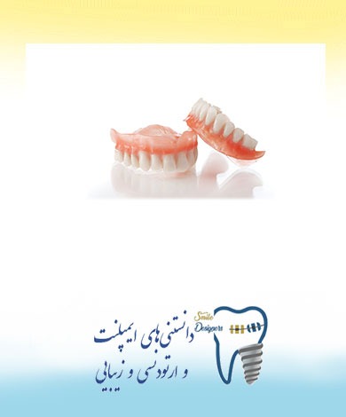 دندان مصنوعی کامل توسط متخصص پروتزهای دندانی وایمپلنت در تهران