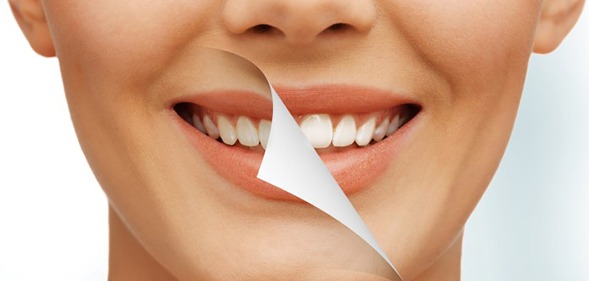 سفید کردن یا بلیچینگ دندان‌ها توسط متخصص زیبایی دندان در غرب تهران