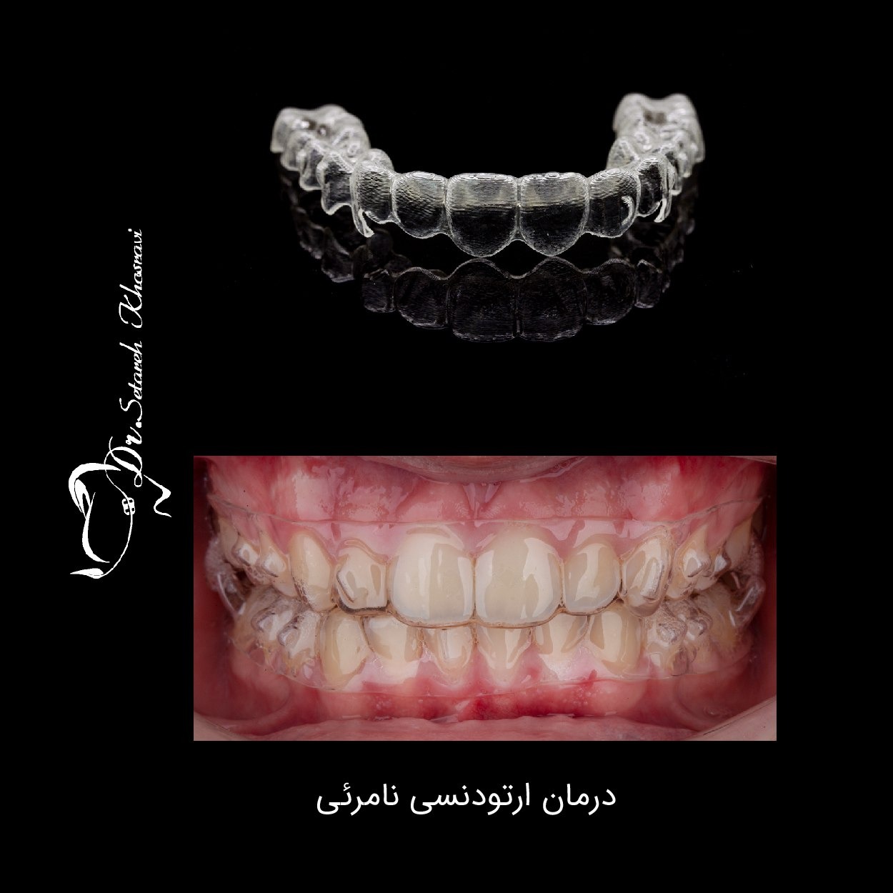 نمونه درمان 3