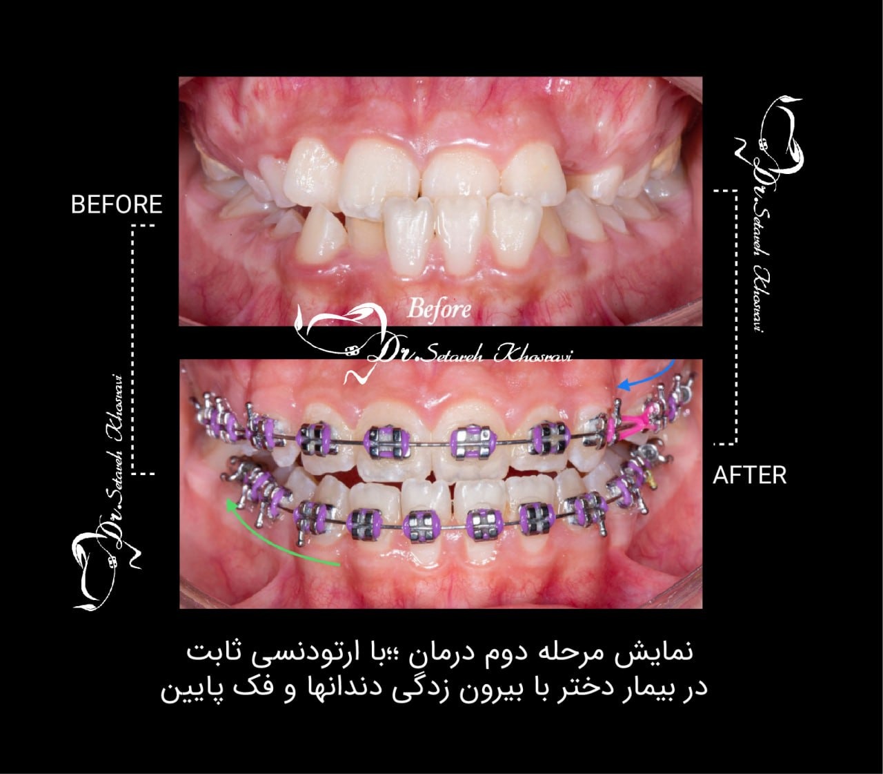 نمونه درمان16