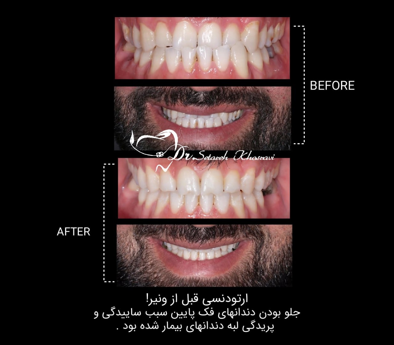 نمونه درمان 15