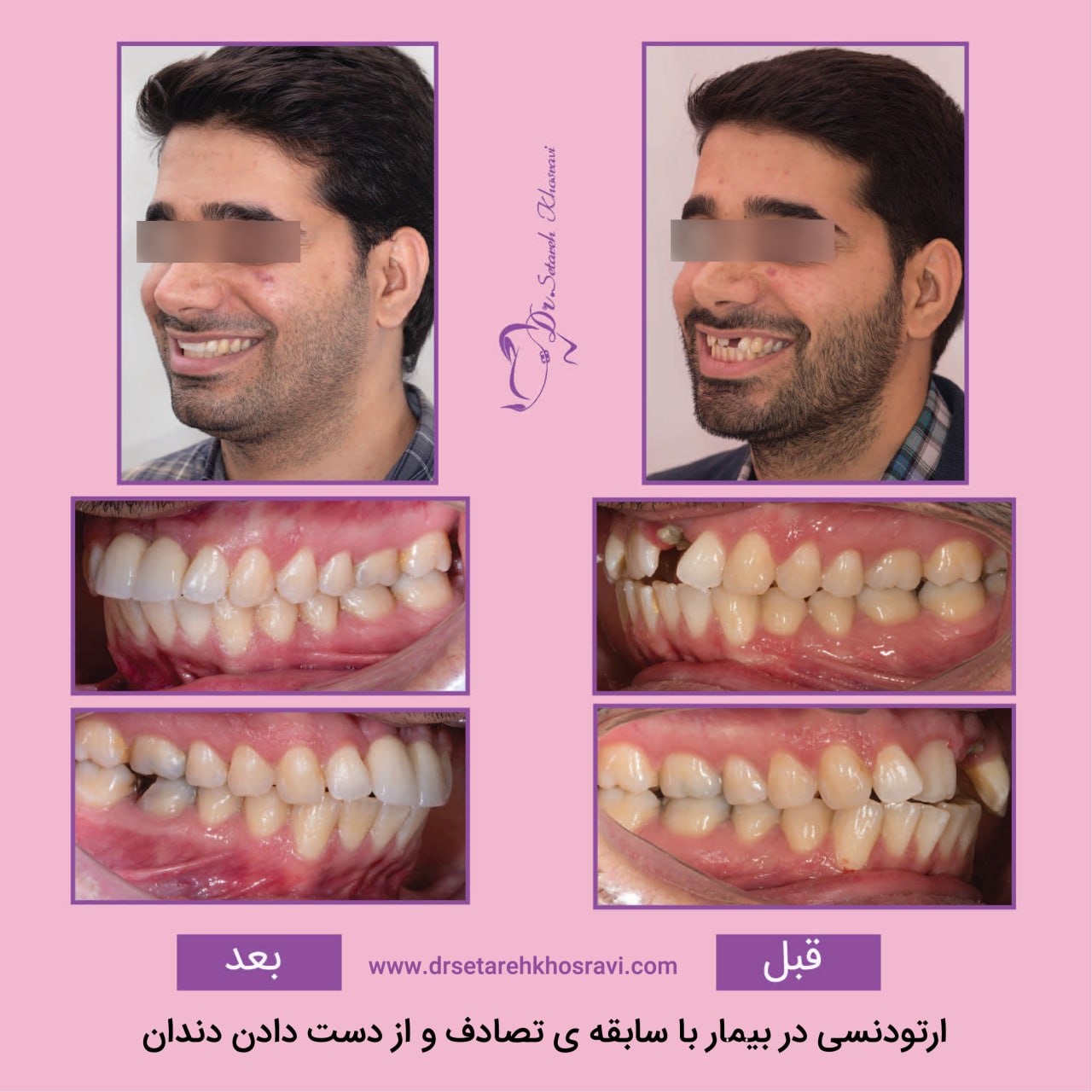 نمونه درمان 19