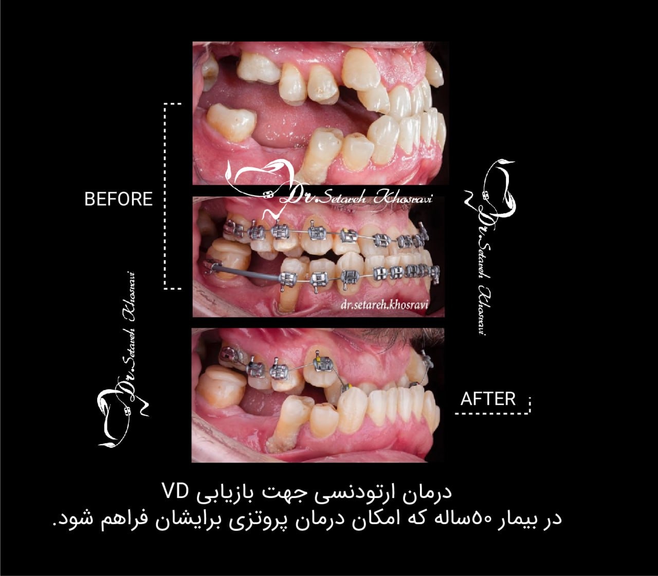 نمونه درمان 11