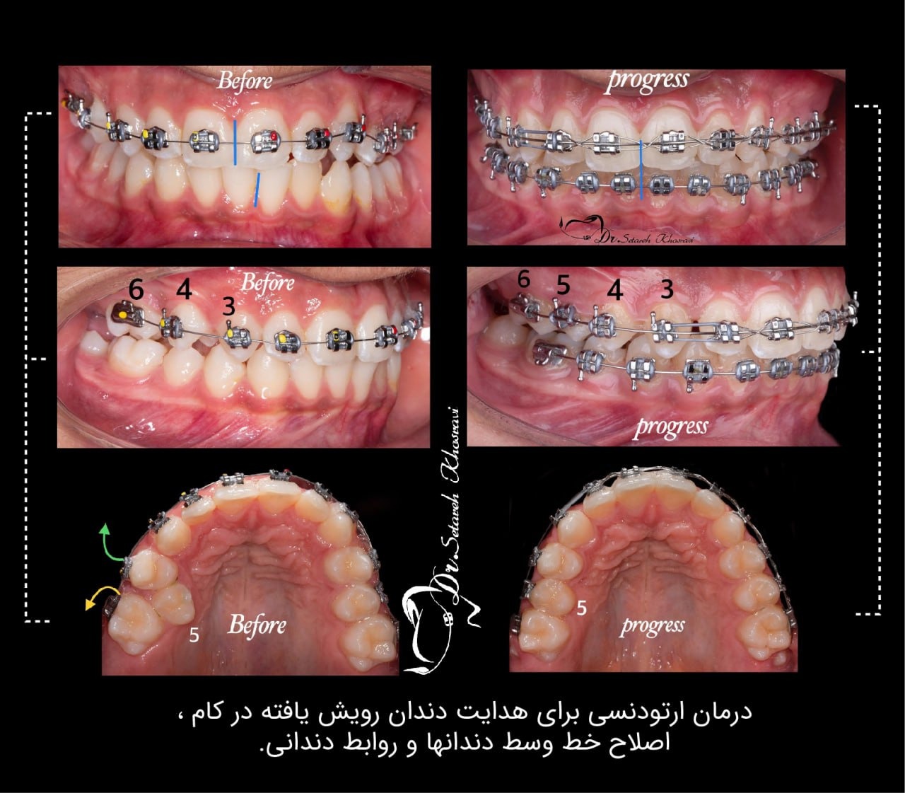 نمونه درمان18
