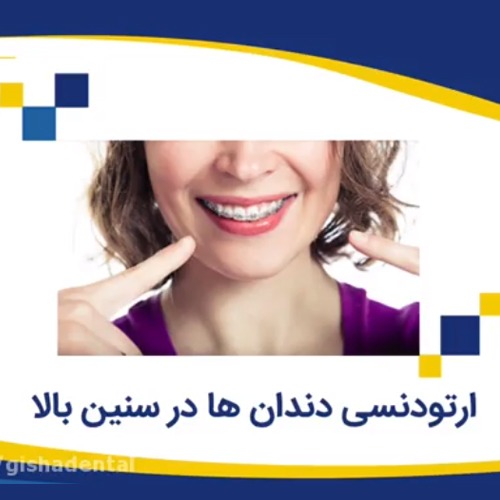 ارتودنسی دندانها حتی در سنين بالا