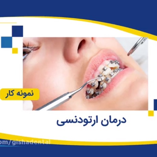 نمونه کار - درمان ارتودنسی