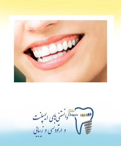 روش های جایگزین کردن دندان های از دست رفته توسط متخصص پروتزهای دندانی و ایمپلنت در تهران