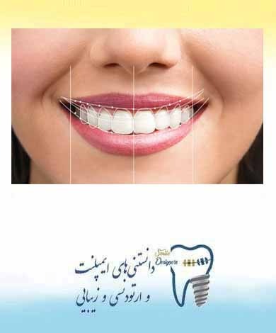 درمانهای زیبایی در دندانپزشکی -قسمت اول