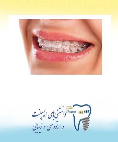 ارتودنسی دندانها  حتی در سنين بالا توسط متخصص ارتودنسی