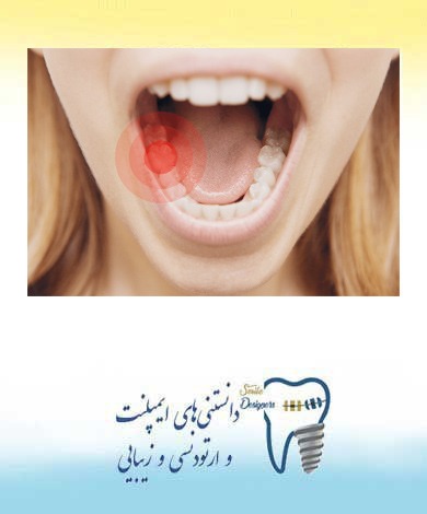 روشهای خانگی درمان دندان درد