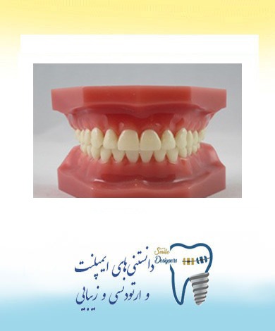 آشنایی با مشکلات بایت و نامرتبی دندان‌ها