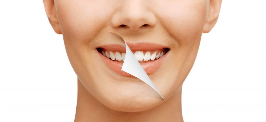 طراحی لبخند ( smile makeover) به فرآیند زیبا سازی ظاهری دندان‌ها و لبخند در دندانپزشکی زیبایی گفته می‌شود که در آن درمان‌هایی مانند لمینت ، باندینگ کامپوزیت، کاشت ایمپلنت و سفید کردن دندان‌ها انجام شود.