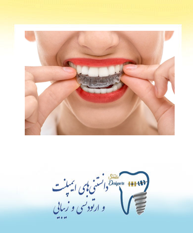 همه چیز در مورد ارتودنسی  دندانها