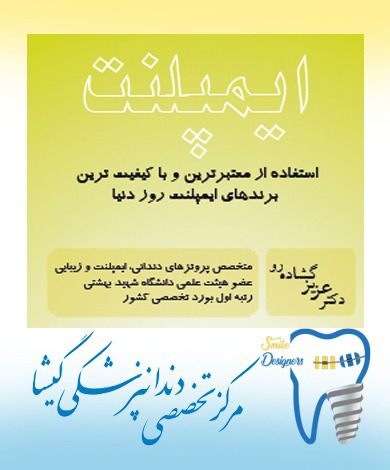 ما متخصص ايمپلنت در تهران هستيم (تفاوت متخصص ایمپلنت  با دندانپزشک )